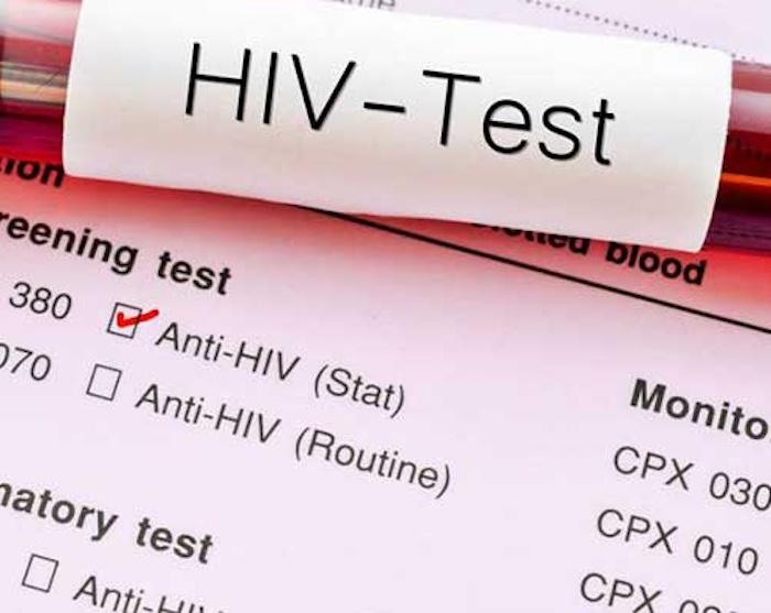 Nữ nghiên cứu sinh tiến sĩ 27 tuổi phát hiện nhiễm HIV, cách mà cô bị lây nhiễm khiến nhiều người "lạnh sống lưng" - Ảnh 1.