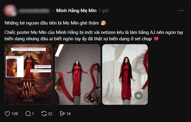 Ngón tay biến dạng của Minh Hằng- Ảnh 3.