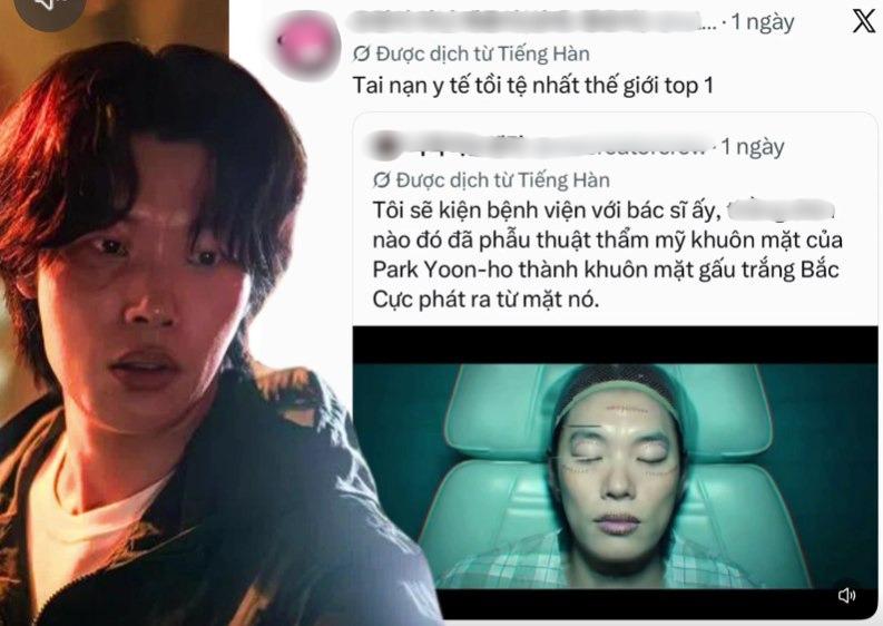 Top 1 tai nạn y tế tồi tệ nhất thế giới: Tốn tiền sửa mặt mà lại xấu đi, 7 triệu người đòi kiện bác sĩ - Ảnh 1.