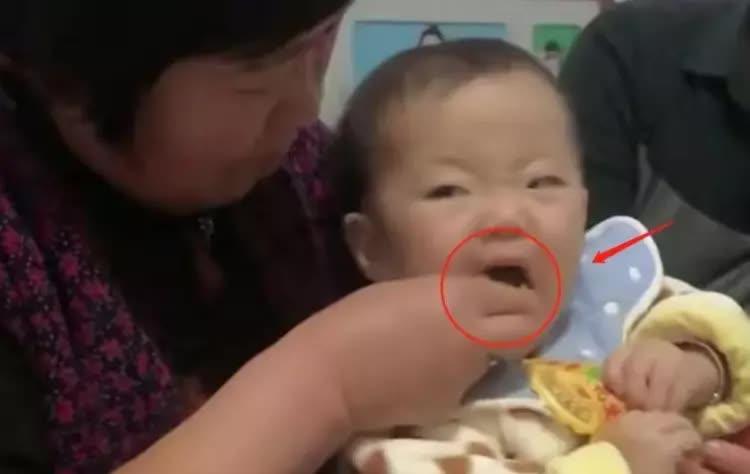 Trẻ không ăn kẹo nhưng vẫn bị sâu răng thì mẹ nên cẩn thận với 4 thói quen  - Ảnh 2.