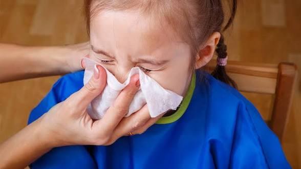 Vì sao trẻ hay bị sổ mũi khi thời tiết thay đổi?- Ảnh 3.