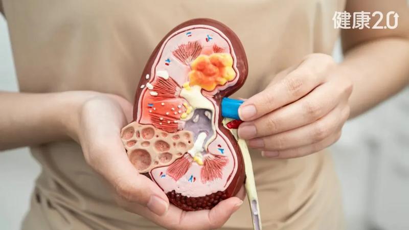 Có người suýt chết vì uống trà thảo dược: 5 loại trà này cực kỳ có hại cho thận vì chúng đẩy nhanh quá trình xơ hóa và tổn thương thận- Ảnh 3.