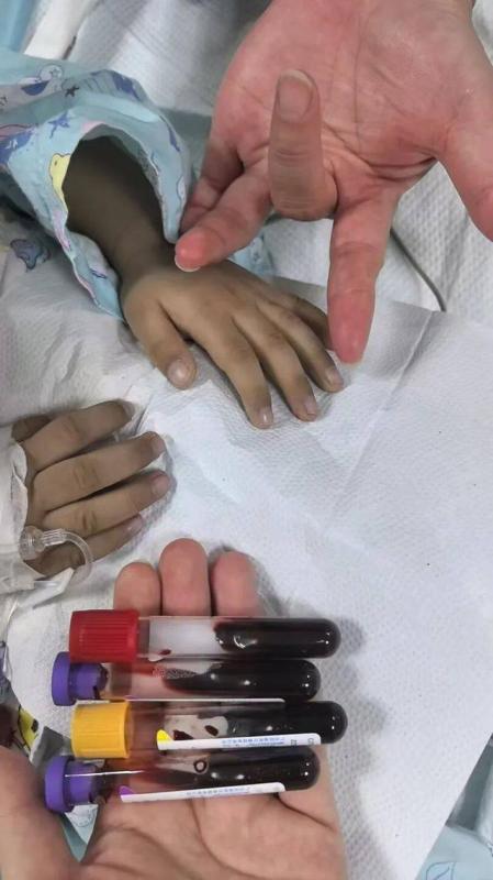 Bé trai 3 tuổi nhập viện vì ngộ độc sau thời gian dài ăn cơm, thức ăn để qua đêm- Ảnh 1.