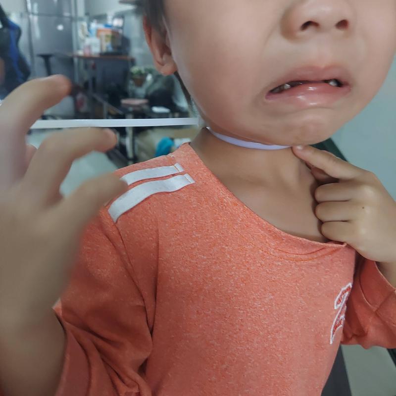 Mẹ trẻ chia sẻ phen "đứng tim" khi thấy con trai bị dây rút nhựa siết chặt cổ- Ảnh 2.