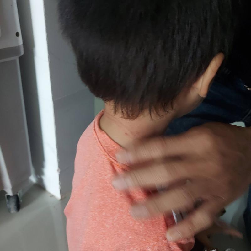 Mẹ trẻ chia sẻ phen "đứng tim" khi thấy con trai bị dây rút nhựa siết chặt cổ- Ảnh 3.