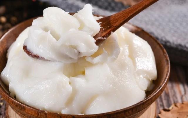 Ăn mỡ lợn mỗi ngày, người đàn ông 75 tuổi ngỡ ngàng khi đi khám- Ảnh 2.