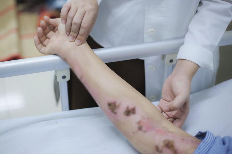 Đang đi ngoài đường, cô gái 33 tuổi bị sét đánh cháy sém cổ - Ảnh 1.