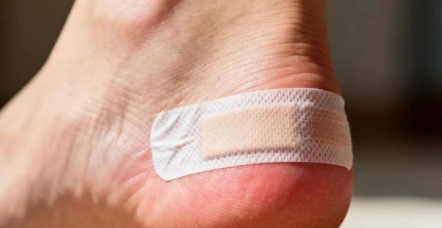 Bé gái sốt 39,3 độ C suốt 2 ngày, nhập viện mới phát hiện thủ phạm là 1 miếng băng cá nhân- Ảnh 3.