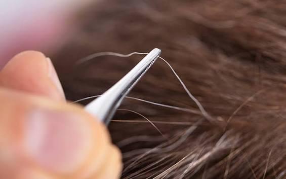 Lời khuyên cho tất cả những người cứ thấy tóc bạc là nhổ- Ảnh 1.