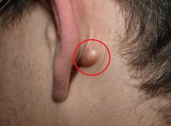 Người đàn ông 20 tuổi tử vong, bác sĩ nói thẳng đừng "ngó lơ" 2 dấu hiệu xuất hiện mỗi đêm - Ảnh 1.