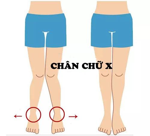 Kiểu dáng chân