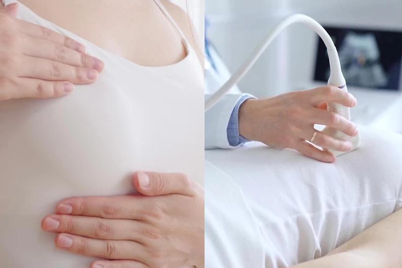 Nữ bác sĩ được chẩn đoán mắc "ung thư vú nguy hiểm nhất" đã nhấn mạnh "thói quen" suýt cướp đi mạng sống của mình - Ảnh 1.