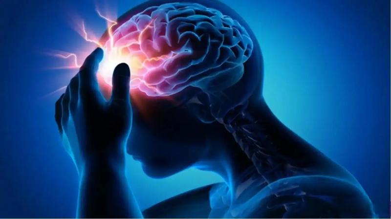 5 dấu hiệu bất thường nhiều người tưởng do tuổi già, nhưng có thể cảnh báo đột quỵ - Ảnh 4.