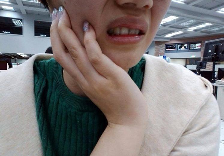 Đau răng suốt 3 năm, người phụ nữ đi nhổ răng về lại càng đau thêm, bác sĩ phát hiện 1 sự thật - Ảnh 2.