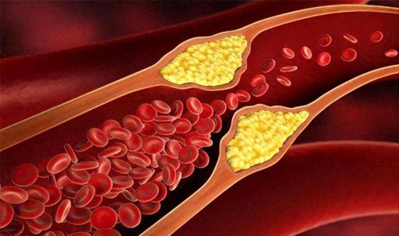 2 thực phẩm này làm tăng lượng mỡ trong máu mạnh hơn cả thịt chiên rán, nhiều người ăn chúng mỗi ngày mà không hề nhận ra - Ảnh 5.