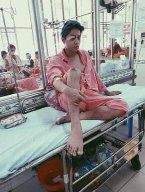 Nam ca sĩ điển trai từng vỡ xương gò má, liệt nửa mặt: Lui về hậu trường suốt nhiều năm- Ảnh 2.