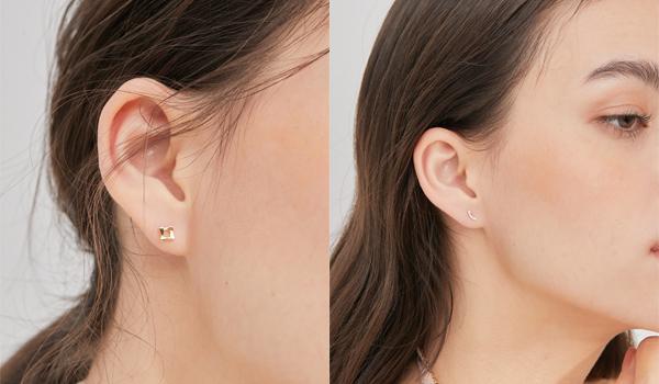 Tai mọc kín đốm đen như “trứng kiến”, bác sĩ cũng nổi da gà: Thủ phạm là vật dụng quen thuộc nhiều người dùng chung mỗi ngày - Ảnh 2.