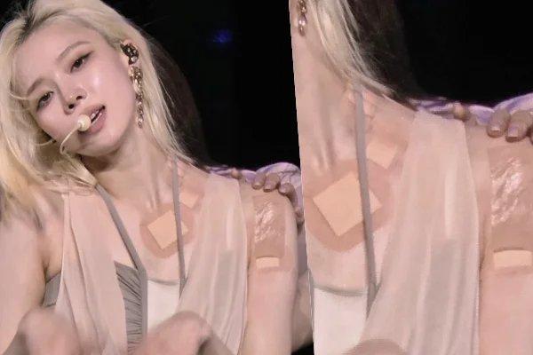 "Bạn gái Jung Kook" lộ hình ảnh xót xa trên sân khấu, bệnh nặng đến mức phải nghỉ diễn - Ảnh 6.