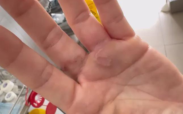 Giun đũa chó mèo có thể gây tổn thương nhiều cơ quan - Ảnh 1.