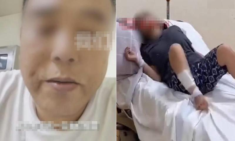 Người đàn ông qua đời sau 47 ngày Vì không tiêm vaccine dại khi bị chó cắn - Ảnh 1.