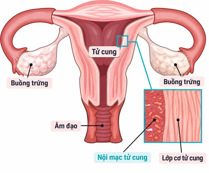 Sau mãn kinh thấy dù chỉ 1 dấu hiệu này cũng đừng chủ quan: Có thể là dấu hiệu ung thư đang âm thầm tiến triển- Ảnh 4.