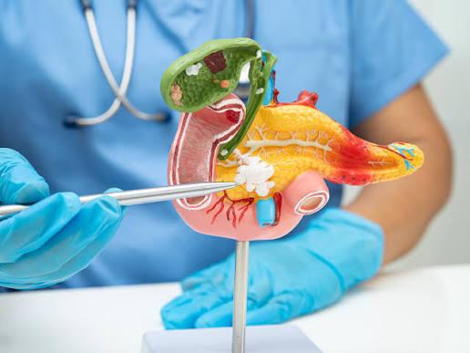 Khám cho nhiều người mắc ung thư tuyến tụy giai đoạn cuối, bác sĩ tiếc nuối: Dấu hiệu xuất hiện sớm nhưng hay bị bỏ qua- Ảnh 2.